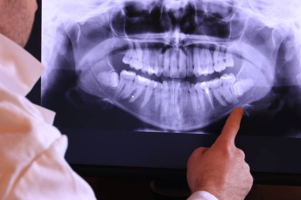 Best Emergency Treatment for Toothache in Williams, OR